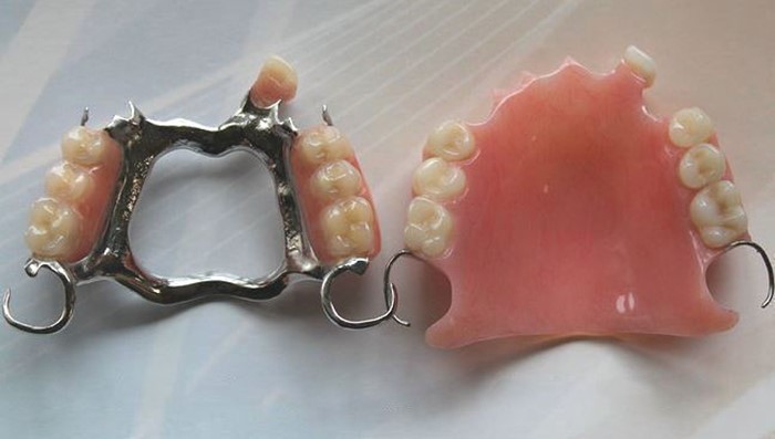 Implant Supported Dentures Playa Del Rey CA 90296